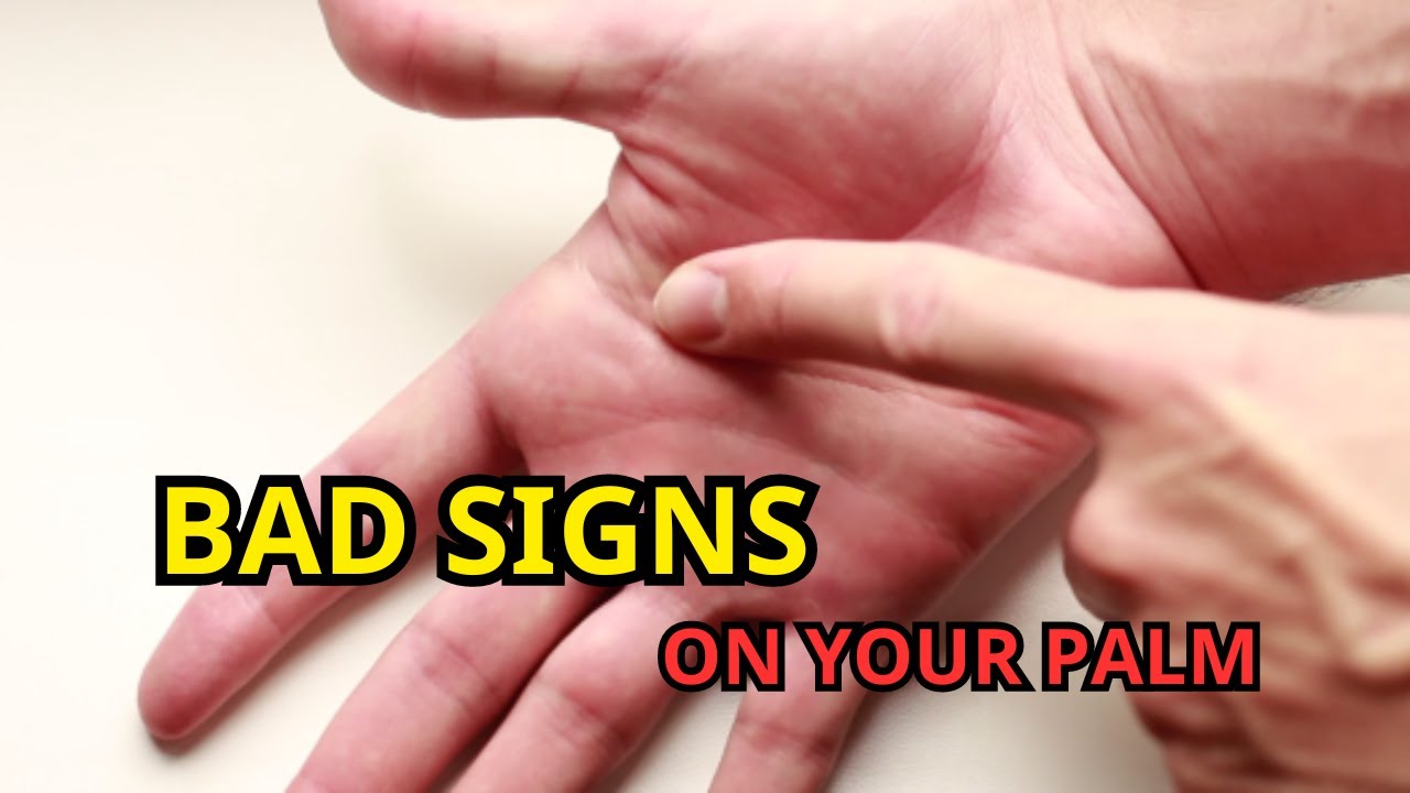 Do You Have These Bad Signs In Your Hand? - Palmistry
