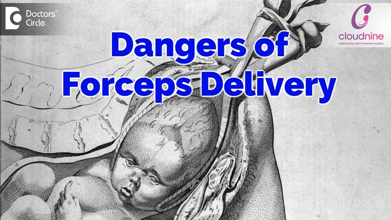 Is Forceps Delivery dangerous? - Dr. Sahana Hedge of Cloudnine Hospitals | Doctors&rsquo; Circle