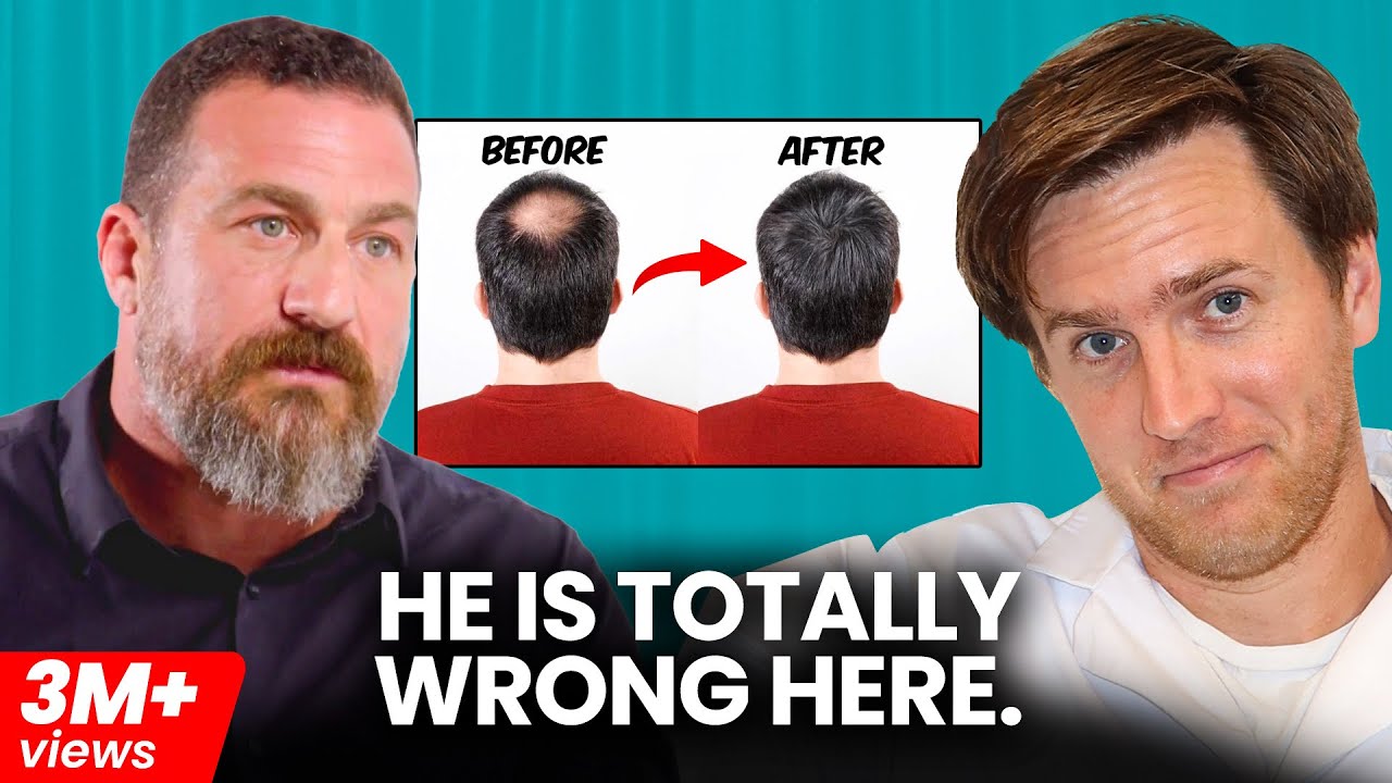 Andrew Huberman’s Is Absolutely Wrong About Hair Loss?