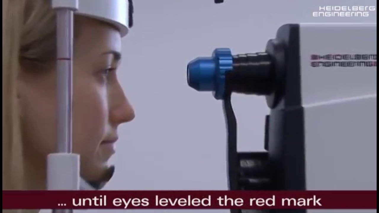 HOW TO: SPECTRALIS Anterior Segment OCT Module   The perfect Acquisition