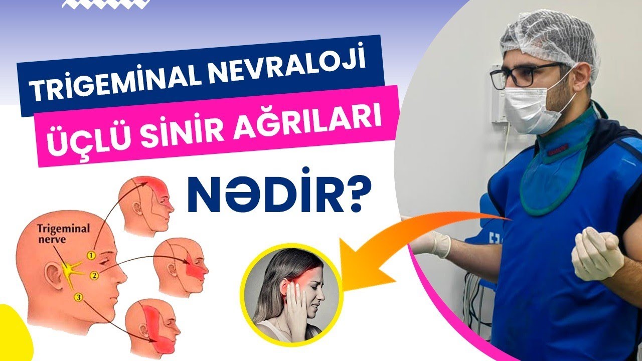 Trigeminal nevralji ( üçlü sinir nevralgiyası ) nədir?