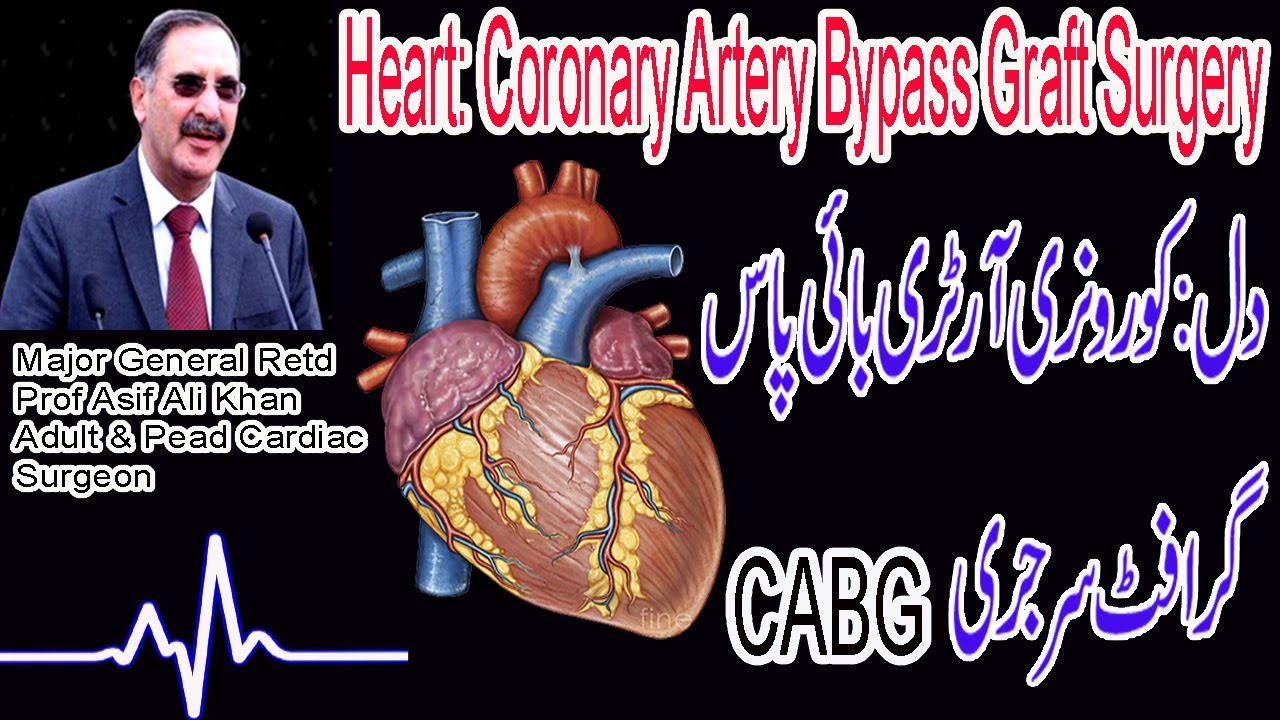 Bypass Surgery CABG Coronary Artery Bypass Graft Surgery in Urdu / Hindi