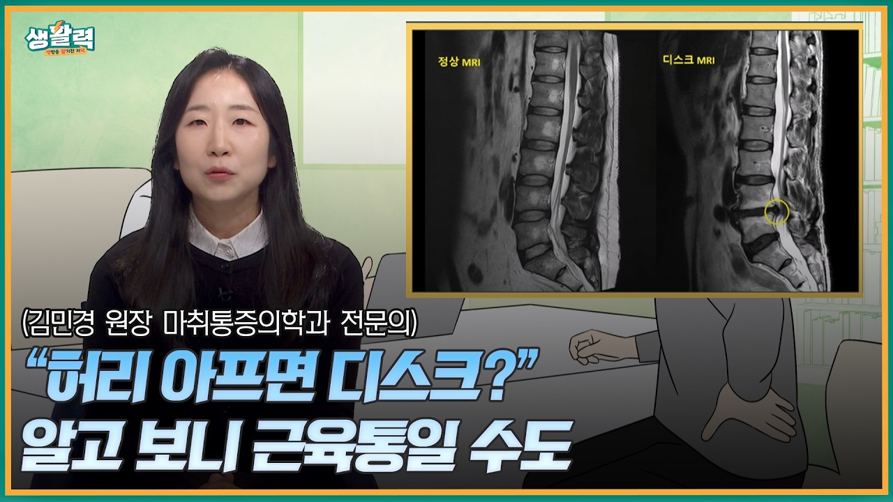 [활기찬클리닉]🚫 “허리 디스크인 줄 알았는데… 근육 때문?” 근막통증증후군의 원인, 증상과 관리법 - 김민경 마취통증의학과 전문의
