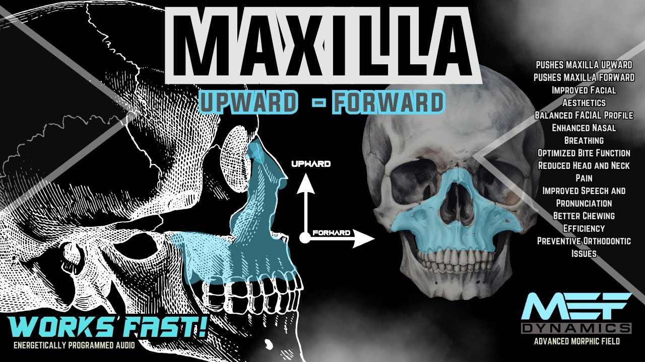 Maxilla Upward Forward