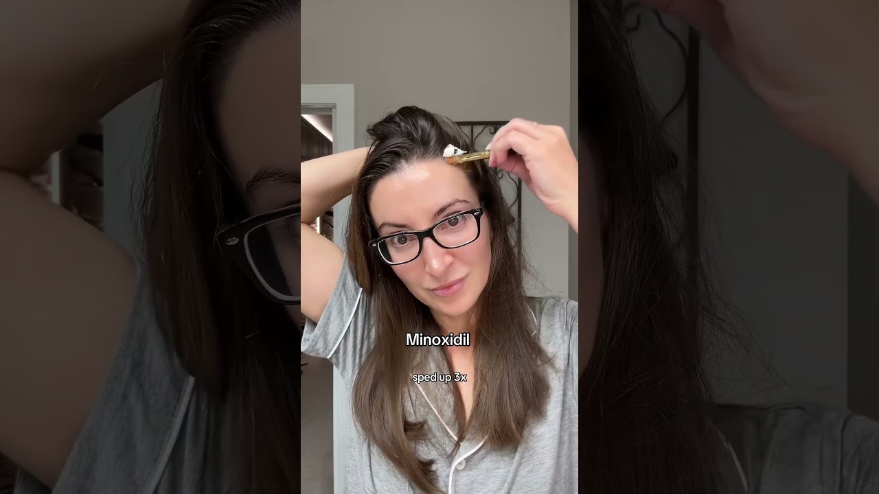 Targeting Hair Loss with a Powerful Duo: Tretinoin + Minoxidil