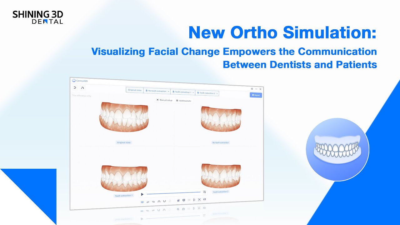 New Ortho Simulation enhances dentist-patient communication through teeth and face simulation.