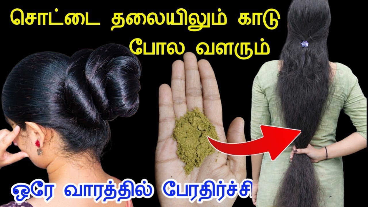 சொட்டை தலையிலும் காடு போல வளரும்....