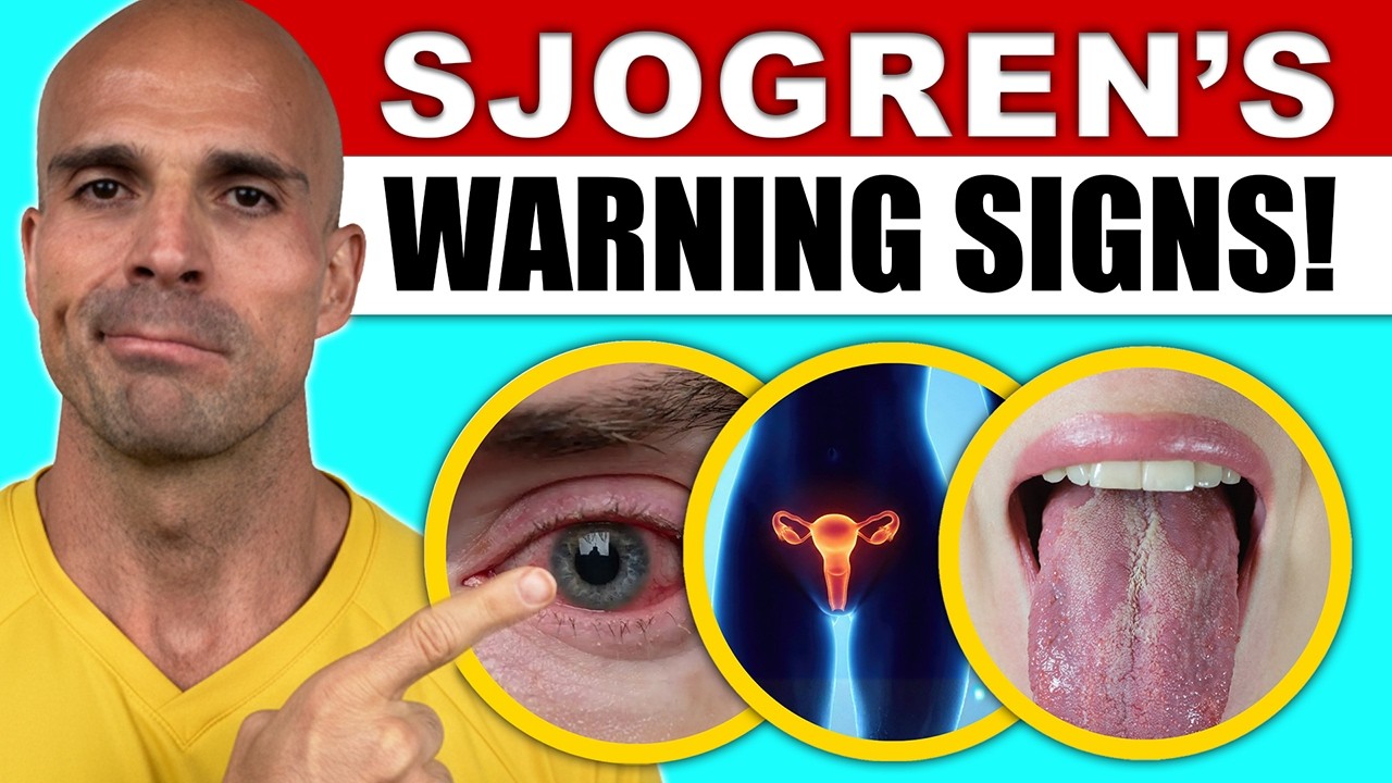 Doctor Explains 10 SIGNS of Sjogren’s Syndrome (And How To Approach Fixing IT)