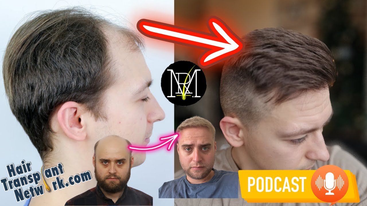 Hair Transplant Network Podcast #16 Mr. Rolandas and John Hair Transplant Chat