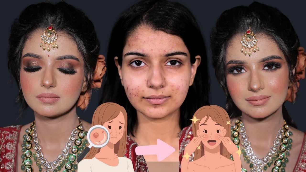 PIMPLE SKIN MAKEUP /oily skin makeup tutorial/Long lasting makeup /Easy makeup tip @BrushStories_
