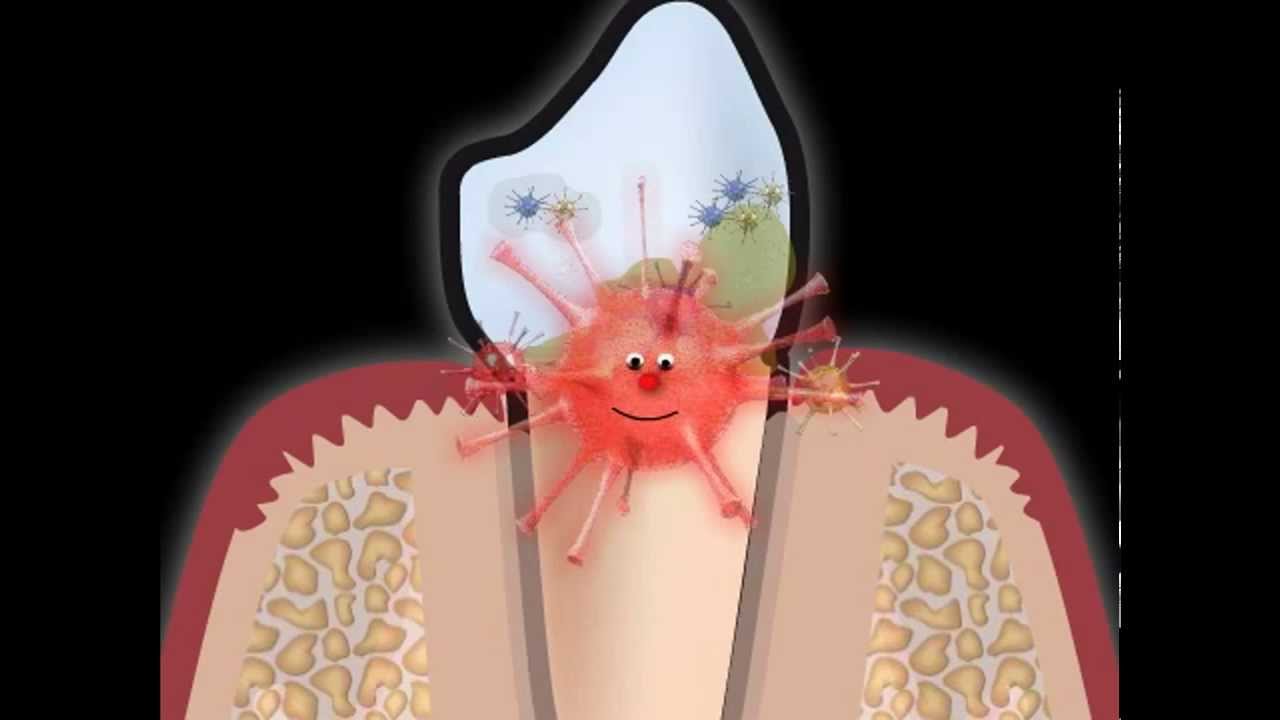 Ustni sprcha