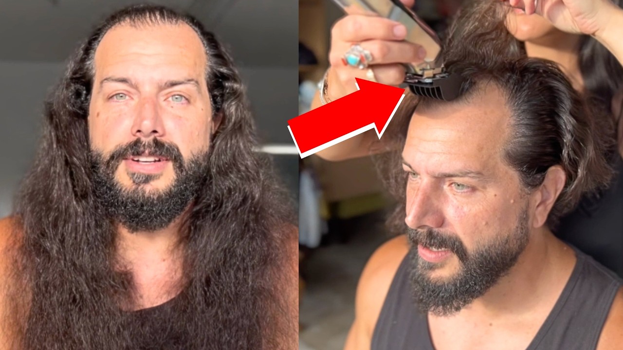 BALDING MAN Documents SHOCKING! Hair TRANSFORMATION *Wholesome*