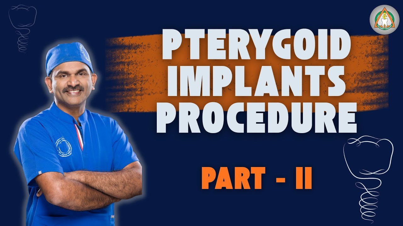 PTERYGOID IMPLANTS vs SINUS LIFT IMPLANTS - PART II 