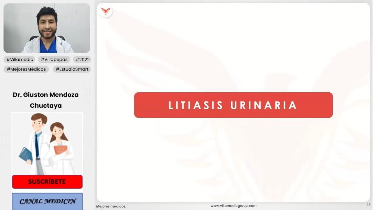 LITIASIS URINARIA - UROLOGÍA - VILLAMEDIC