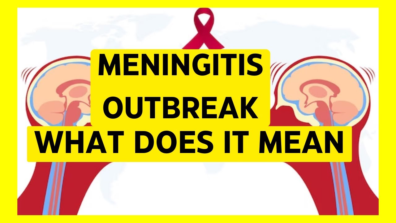 MENINGITIS OUTBREAK: WHAT DOES IT MEAN