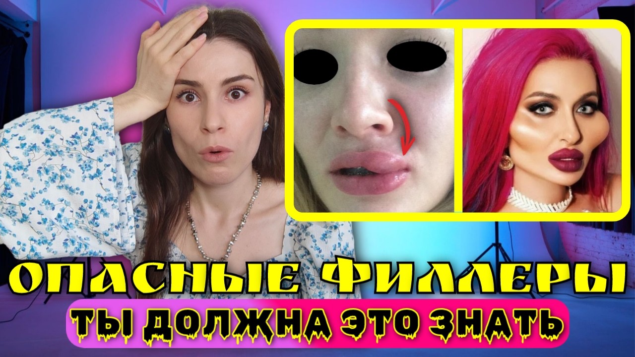 Осложнения филлеров/Миграция/Отек/ Правда о контурной пластике, которую не расскажут.