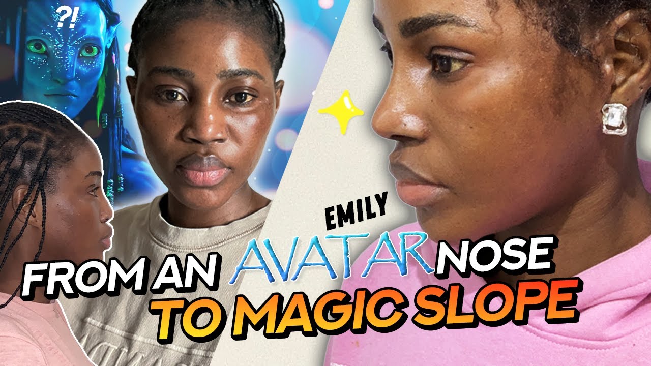 EMILY'S STUNNING RESULT!😍 | Emily's life-changing plastic surgery journey at BRAUN!