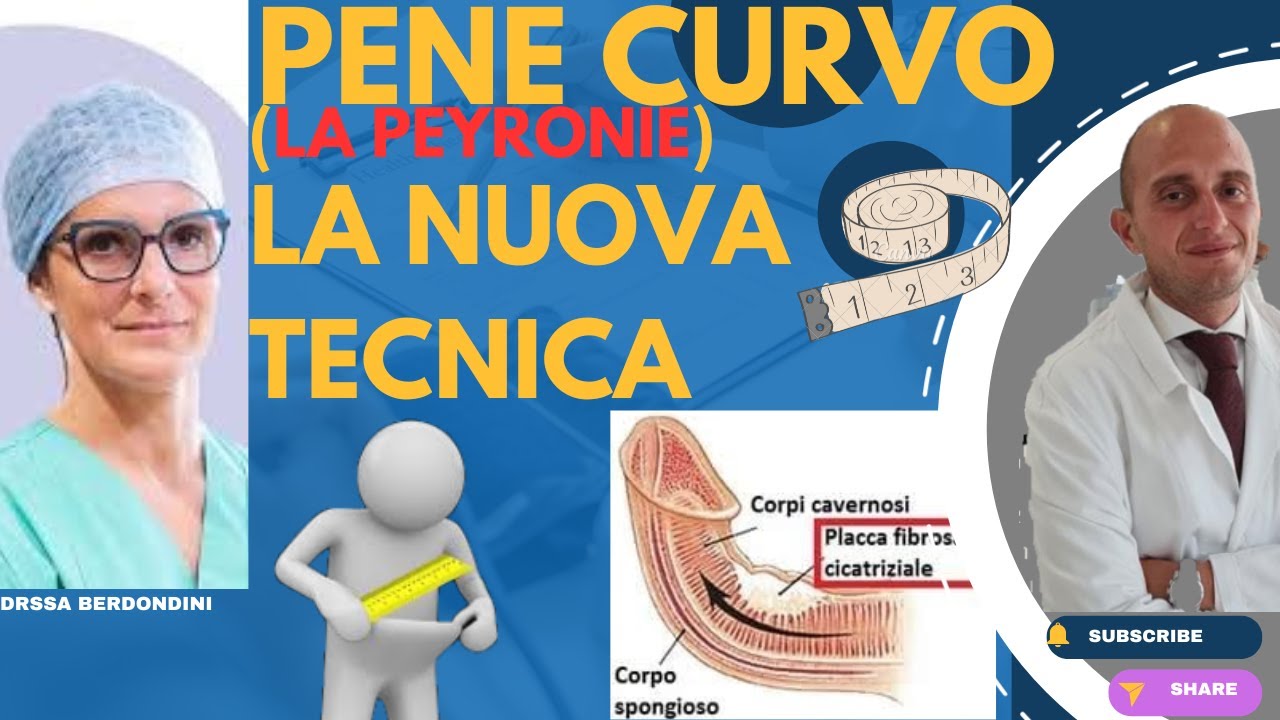 La Peyronie: le cellule staminali risolvono la patologia