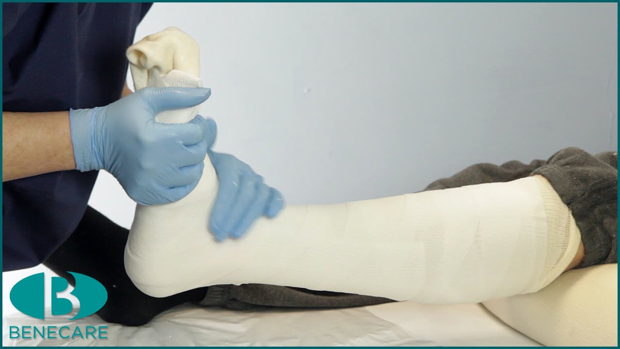 How to Apply a Below Knee Focused Rigidity Cast (FRC)