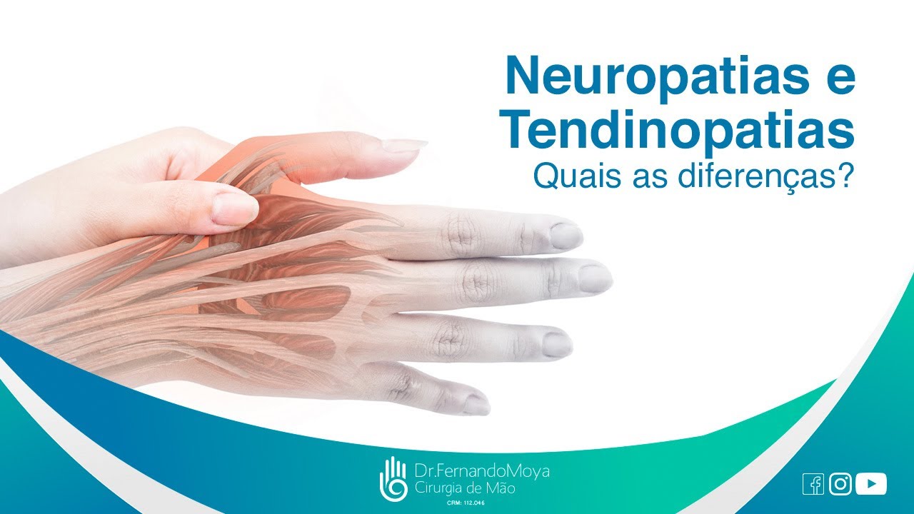 Neuropatias e Tendinopatias. Quais as diferenças? | Dr. Fernando Moya CRM 112046