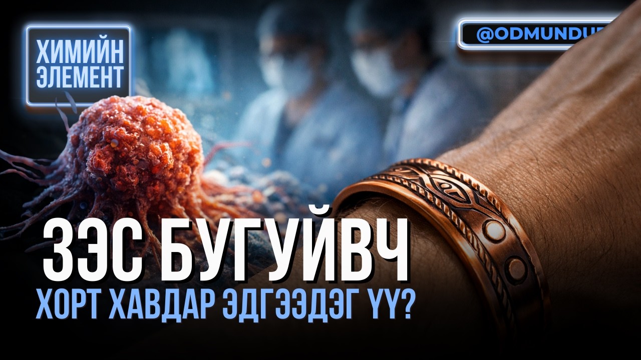 Зэс бугуйвч хорт хавдар эдгээдэг үү? - ХИМИЙН ЭЛЕМЕНТҮҮДИЙГ ХЭРХЭН НЭЭСЭН БЭ?