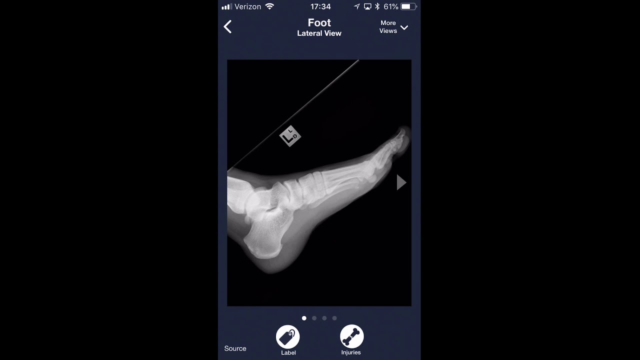 Sublux Video App Review