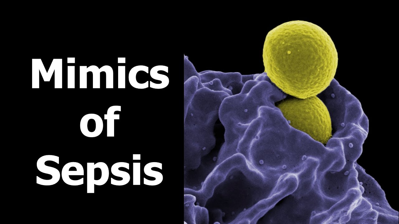 Mimics of Sepsis