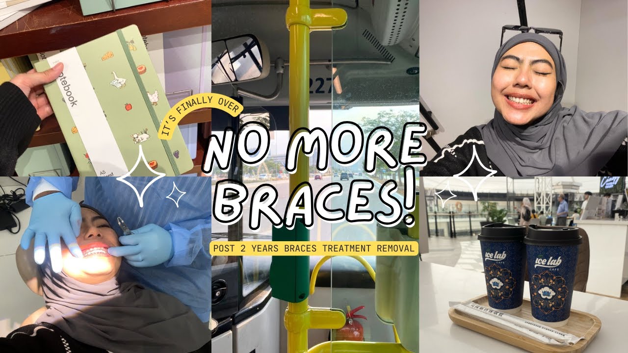 GOODBYE ADULT BRACES! Getting My Braces Removed: My 2 Years Experience & Cost Breakdown | Vlog