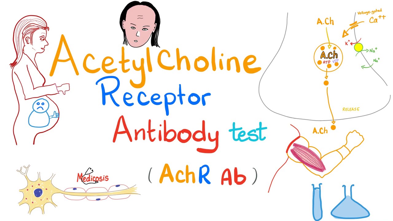 Acetylcholine Receptor Antibody Test | Labs 🧪