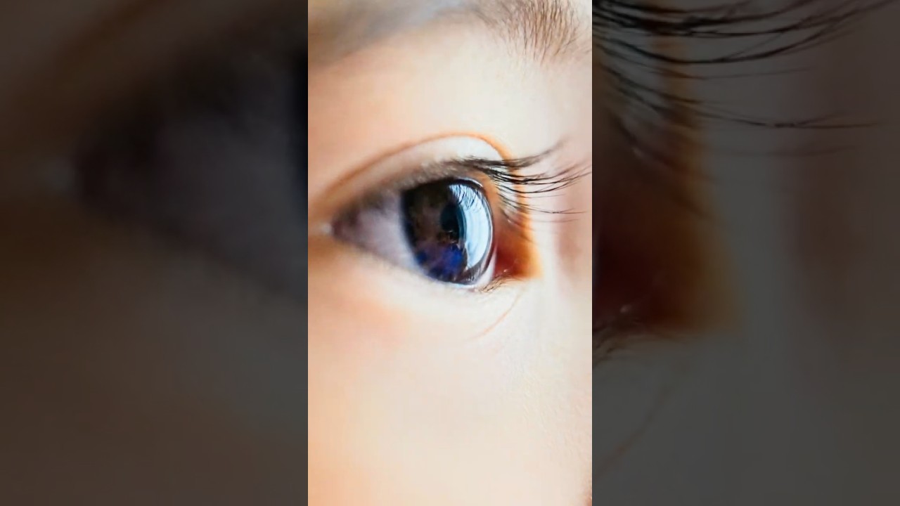 How Atropine Eye Drops Help Slow Myopia in Kids | Pediatric Eye Care Explained