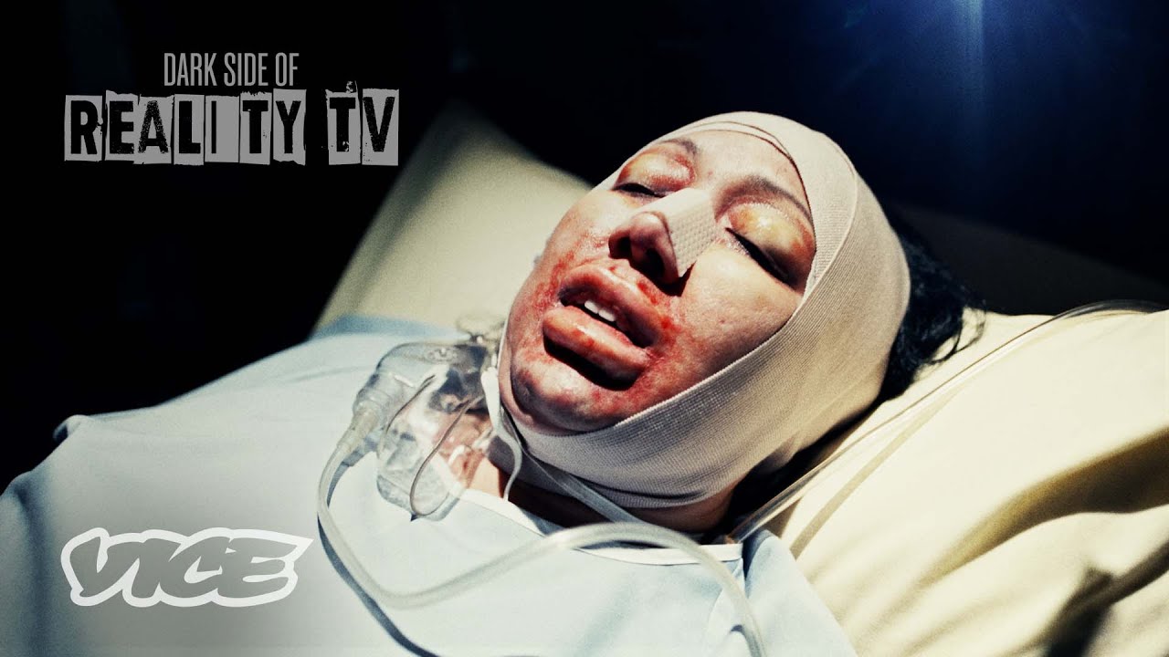 &lsquo;The Swan&rsquo;: A Plastic Surgery TV Nightmare | DARK SIDE OF REALITY TV
