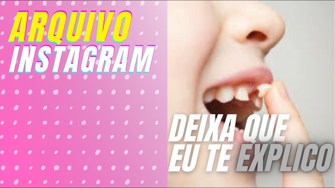 Sonhar com dente o que significa? / dream about tooth what does it mean?