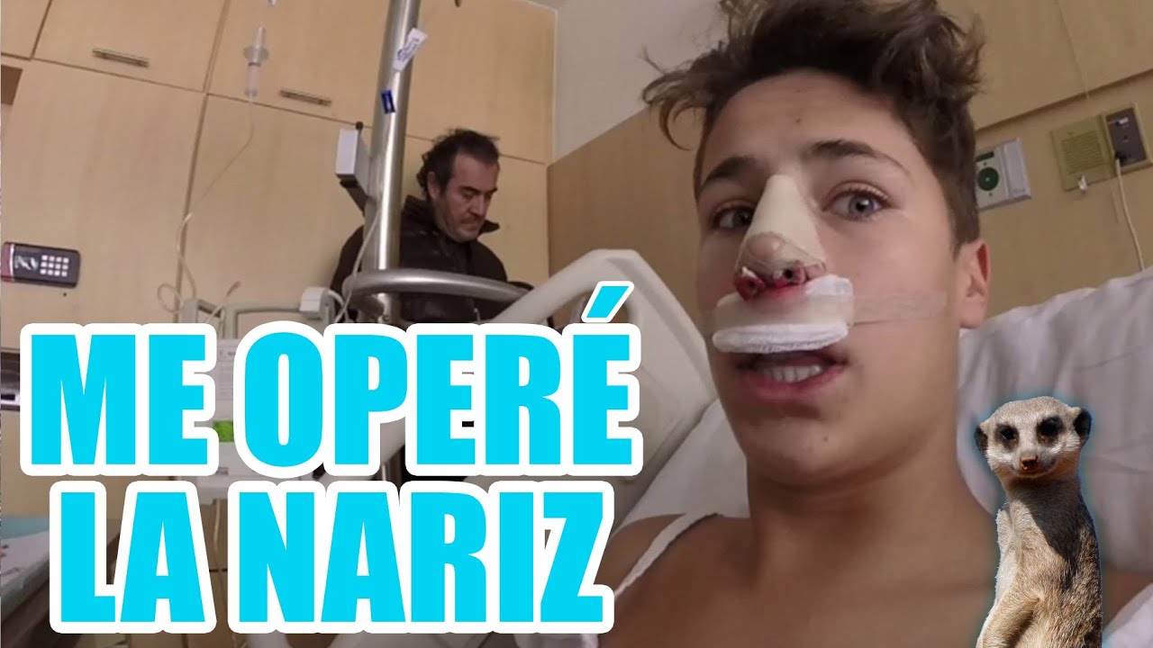 ME OPERÉ LA NARIZ / Juanpa Zurita