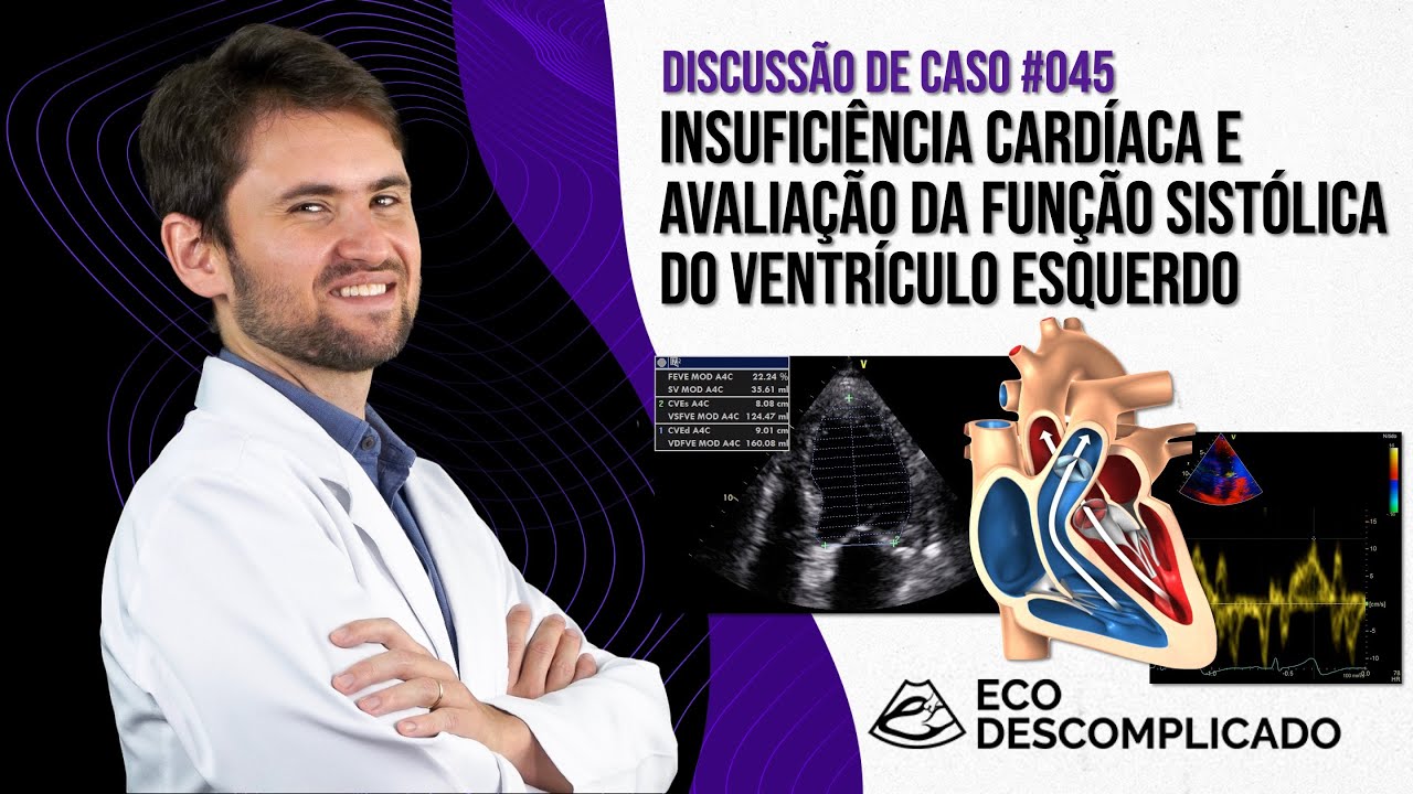 EcoDescomplicado - Discussão de caso AO VIVO #045 - ICC e função sistólica do Ventrículo Esquerdo