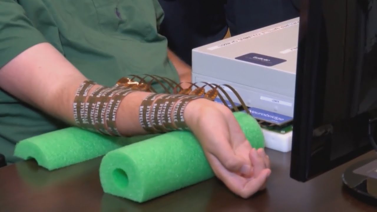 Paralyzed man regains hand movement