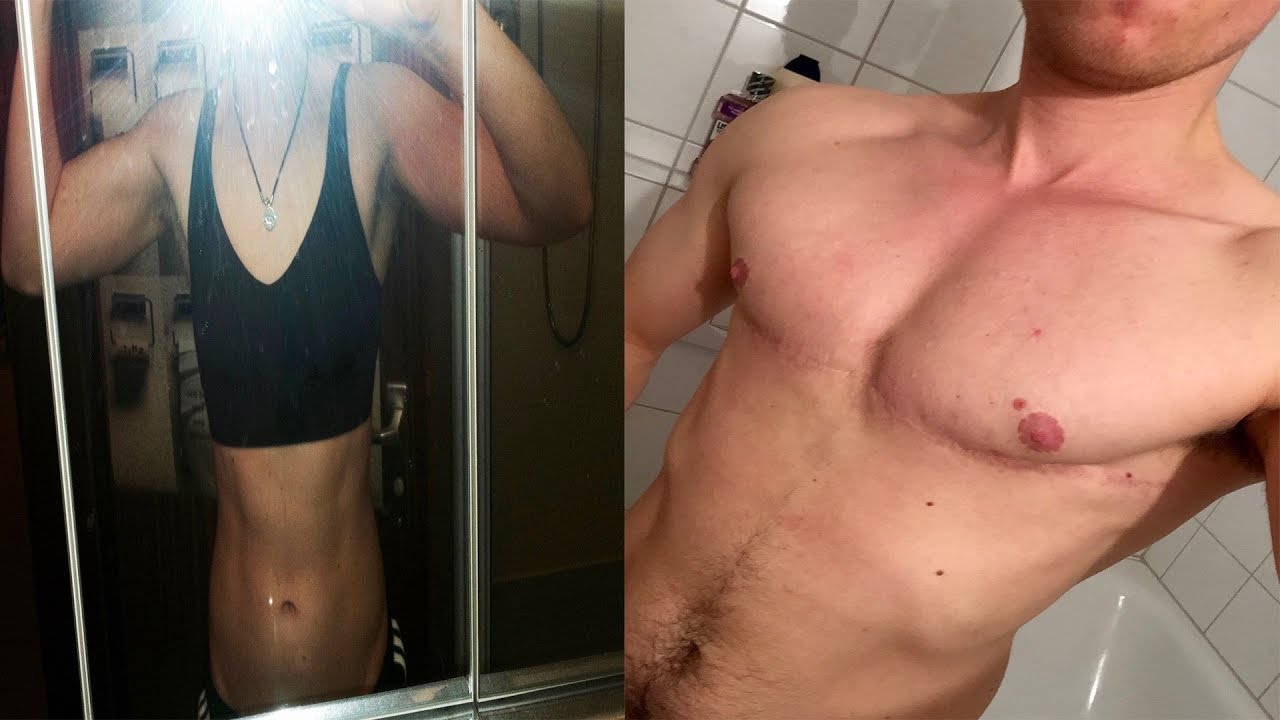 Transsexualität: Mein Weg, meine Geschichte (Doku)