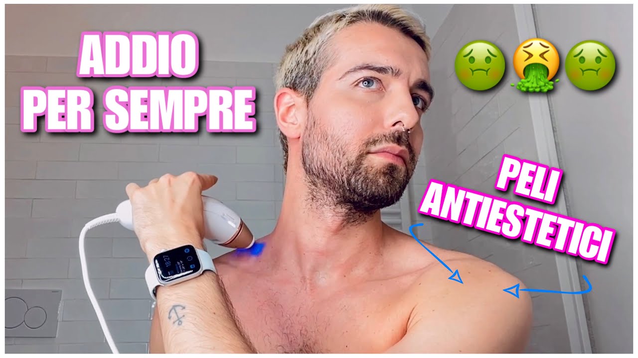VI SVELO UN MIO PROBLEMA IMBARAZZANTE E PROVIAMO A RISOLVERLO INSIEME CON LA LUCE PULSATA!
