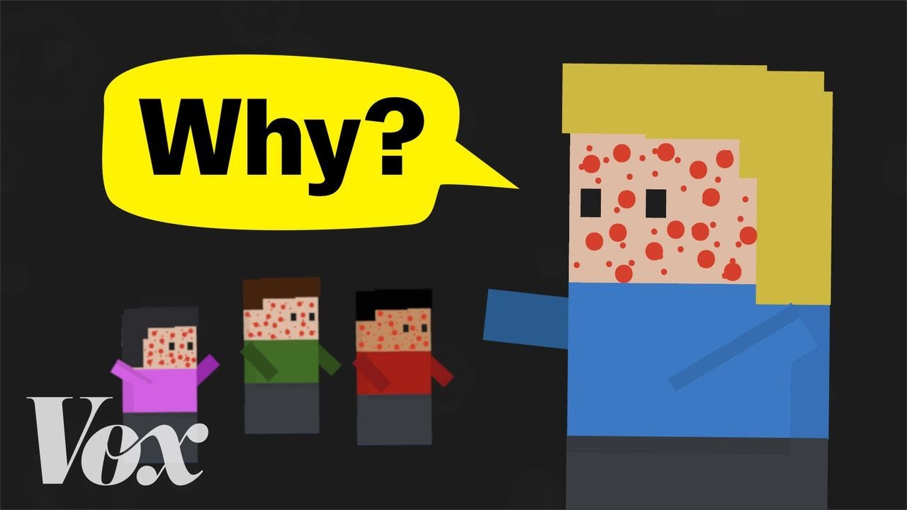 Why measles is back in the US