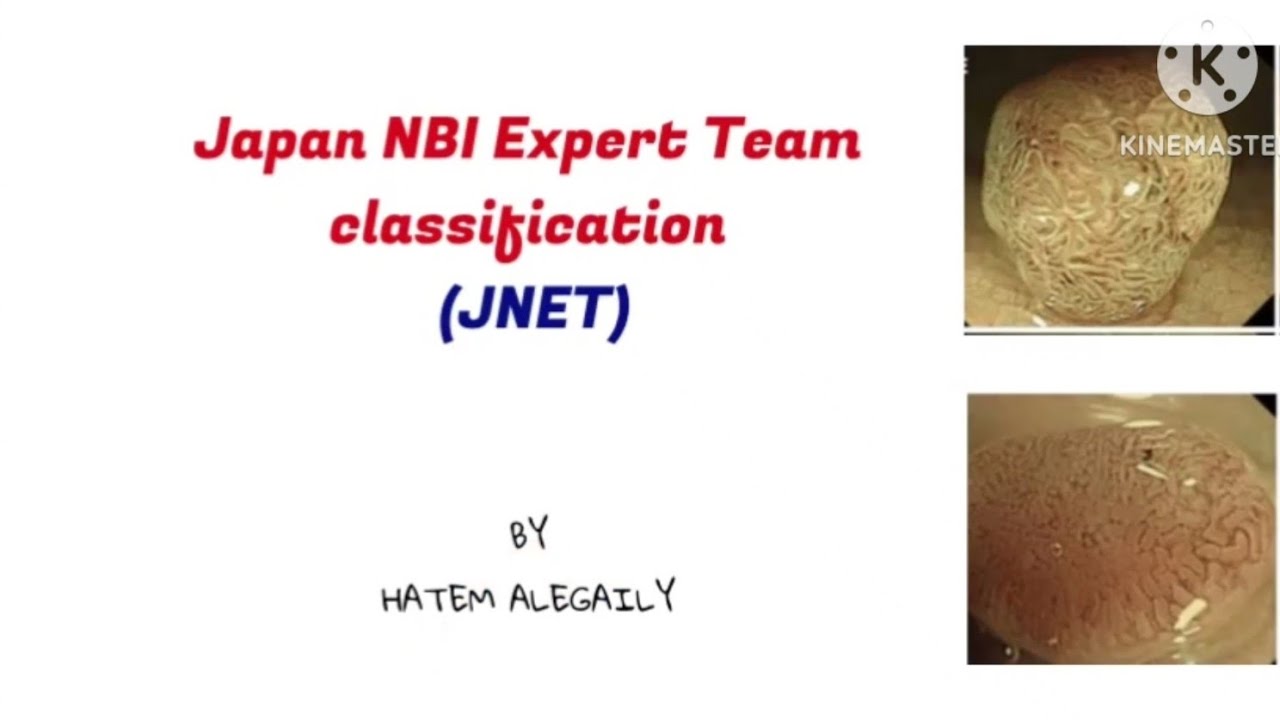 Japan NBI Expert Team Classification (JNET)  
