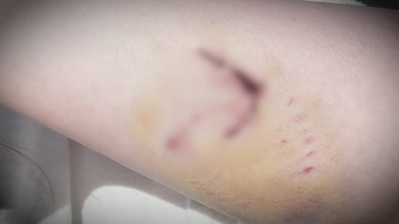 Woman attacked by pack of dogs in SW Okc parking lot