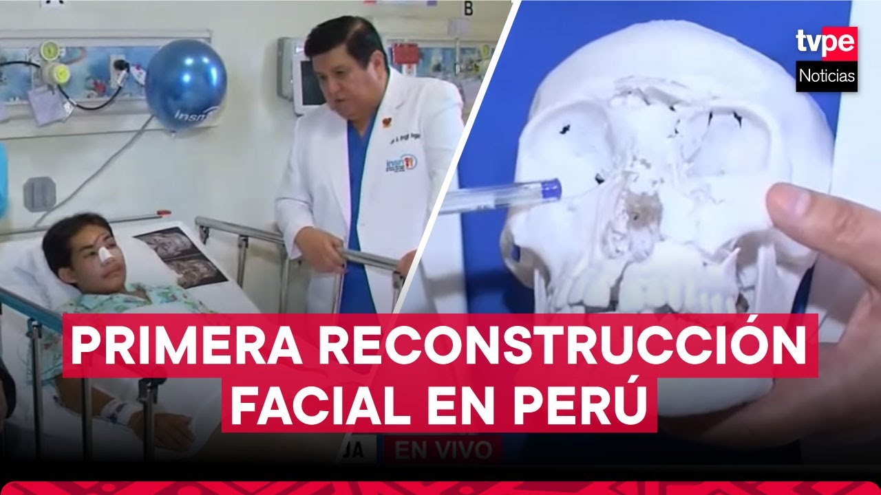 Realizan primera operación de reconstrucción facial en Perú