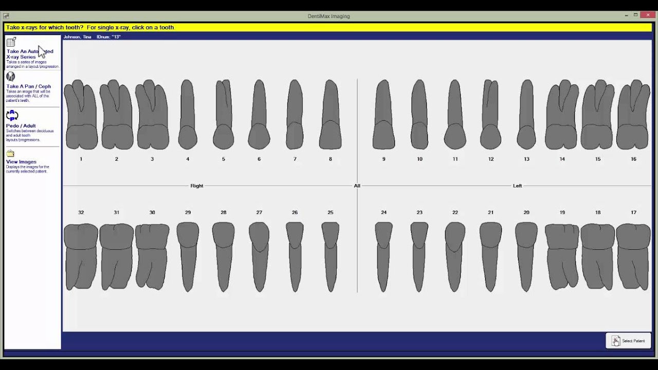 How to Import X-rays | DentiMax Dental Imaging Software Tip