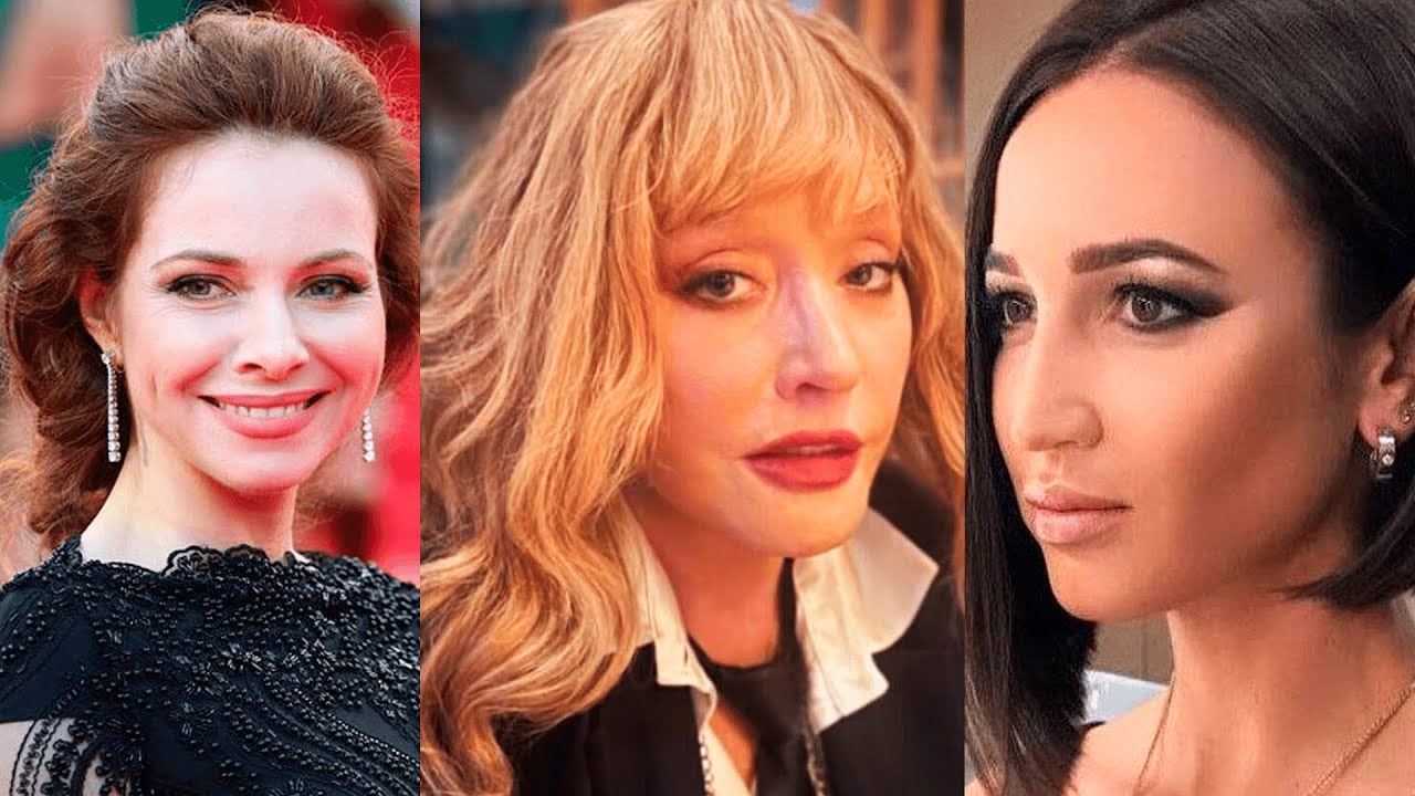 НАСТОЯЩАЯ ВНЕШНОСТЬ РОССИЙСКИХ ЗВЁЗД ДО ПЛАСТИКИ