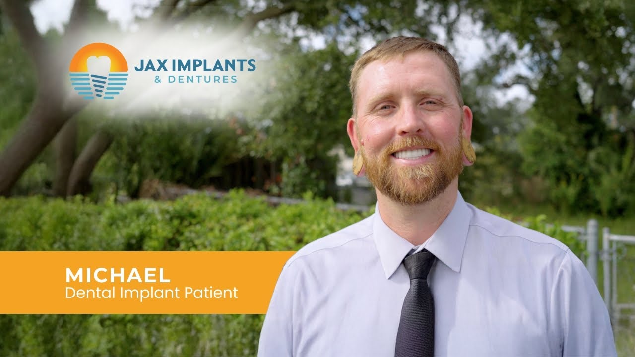 Full Mouth Dental Implants Changed Everything for Michael
