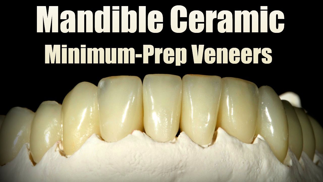 Make Mandible Ceramic Minimum-Prep Veneers With Me