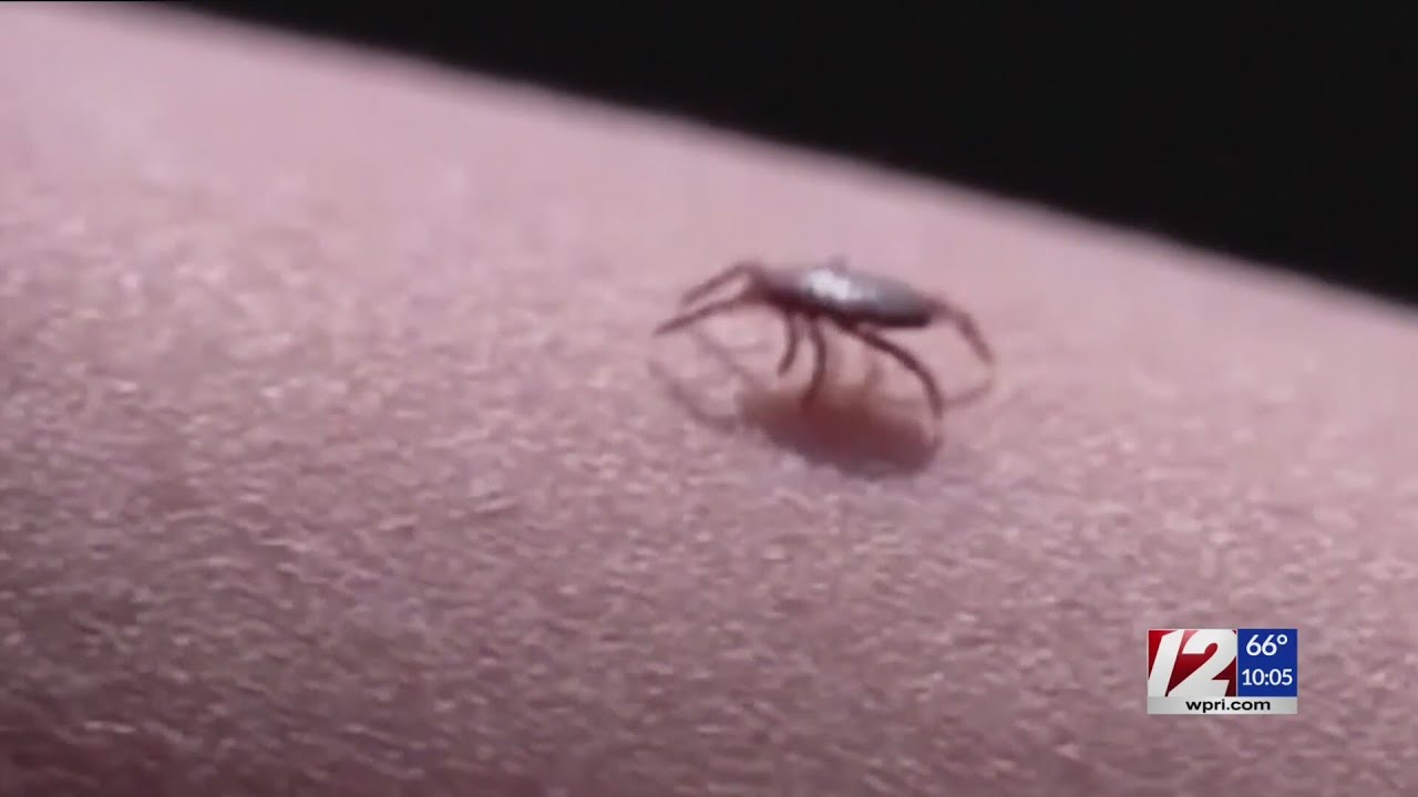 RI woman dies from rare tick-borne ‘Powassan’ disease