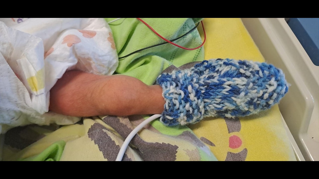 Sta bene ed &egrave; tornato a casa bimbo prematuro nato a 25 settimane
