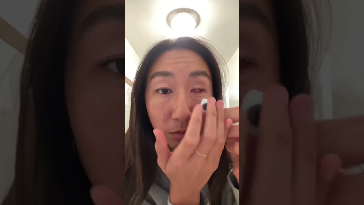 The struggle of having a prosthetic eye&hellip; #prostheticeye #eyecancer #cancersurvivor #eyes