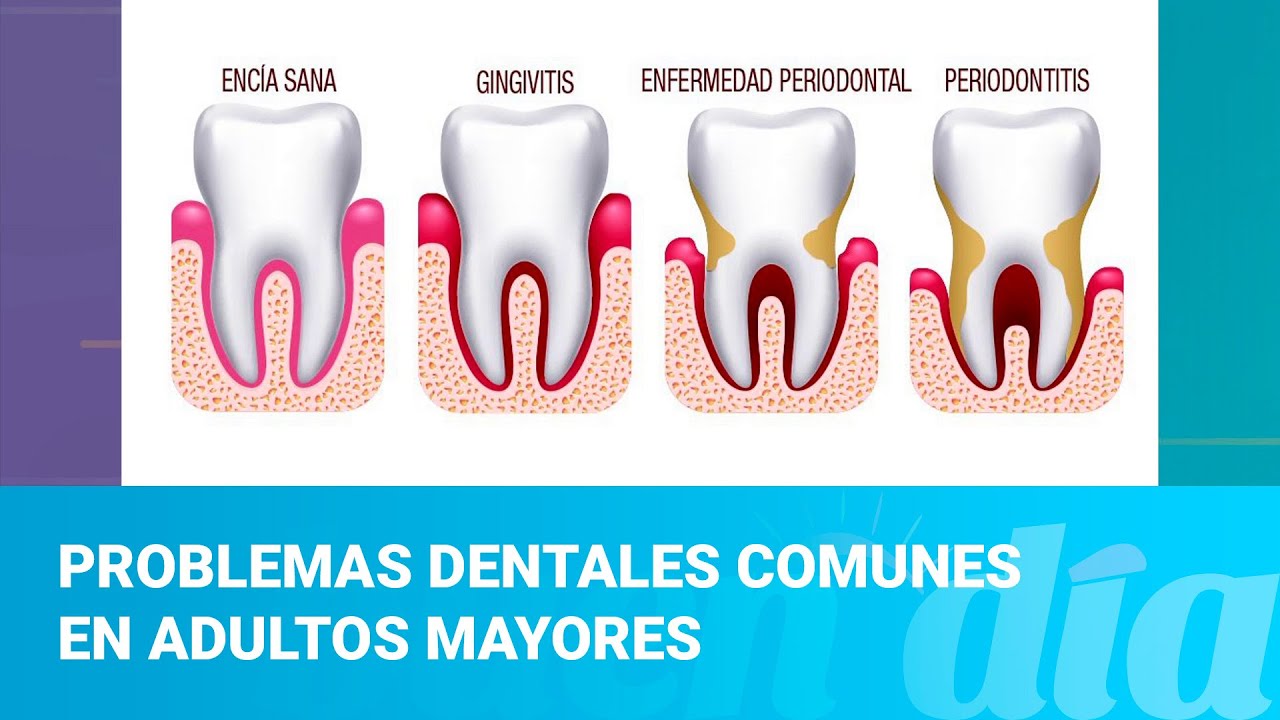 Problemas dentales comunes en adultos mayores