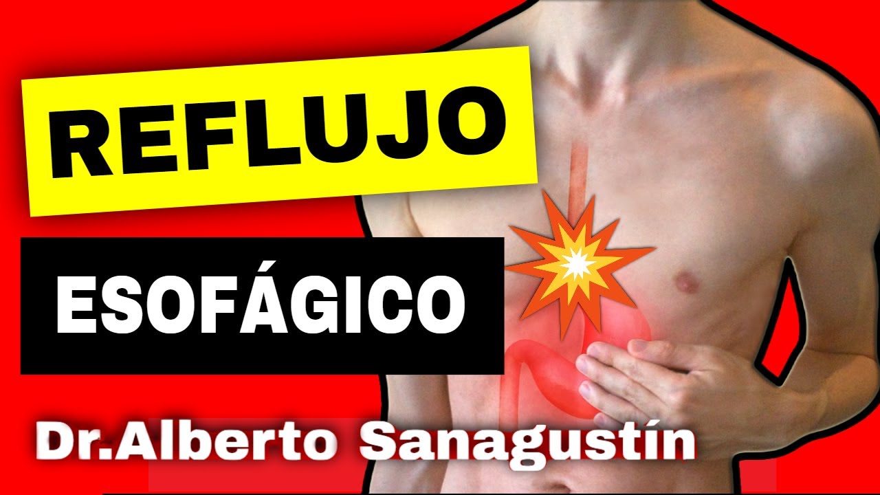 REFLUJO GASTROESOFÁGICO 💥 Causas, síntomas, diagnóstico, recomendaciones y tratamiento